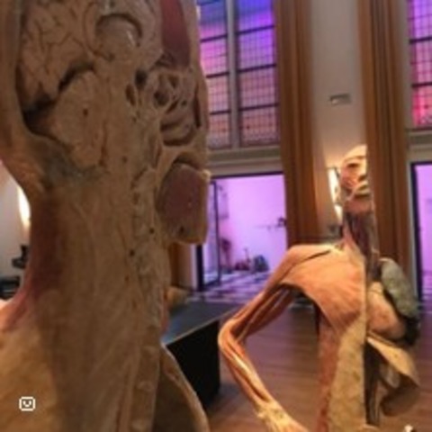 Der menschliche Krper - Sonderausstellung - ALSDORF - 21.06.2025 11:00