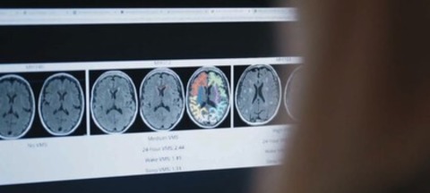 Mein neues altes Ich - Eine Reise in das Mysterium der Menopause - Achern - 04.03.2026 20:00